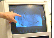 Heart Monitor